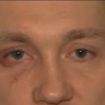 Стали известны имена мужчин, которые подозреваются в нападении на прохожего с ребёнком в Новых Ватутинках